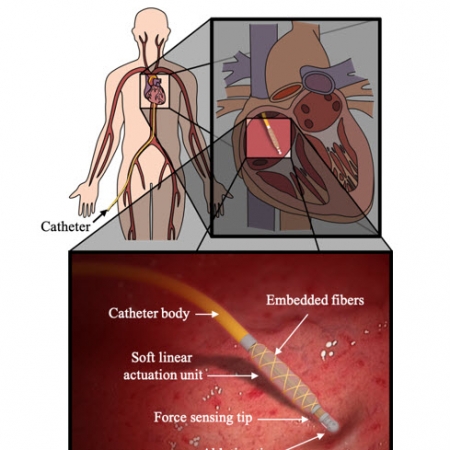 Soft Miniaturized Actuation and Sensing Units for Dynamic Force Control of Cardiac Ablation Catheters