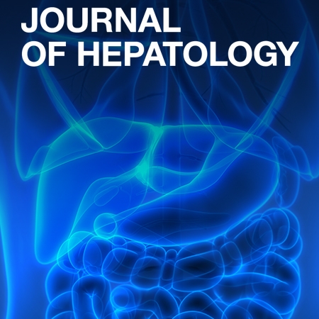 Disease-specific eQTL screening reveals an anti-fibrotic effect of AGXT2 in non-alcoholic fatty liver disease