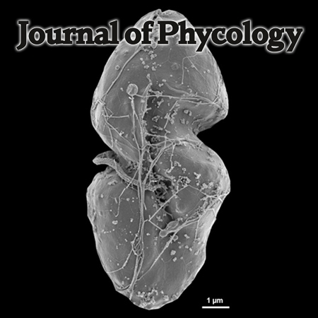 Shimiella gen. nov. and Shimiella gracilenta sp. nov. (Dinophyceae, Kareniaceae), a Kleptoplastidic Dinoflagellate from Korean Waters and its Survival under Starvation