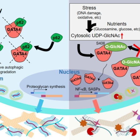 Regulation of senescence-associated secretory phenotypes in osteoarthritis by cytosolic UDP-GlcNAc retention and O-GlcNAcylation