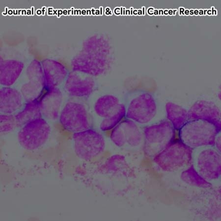 FAM167A is a key molecule to induce BCR-ABL-independent TKI resistance in CML via noncanonical NF-kB signaling activation