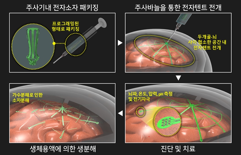 ▲ (Figure 1) Process of minimally invasive large-area brain surface electrode insertion using a biodegradable electronic tent