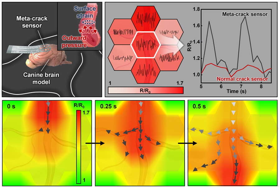 ▲ Figure 3. (Top, Left) Schematic illustration of biomechanical signal monitoring on the vascular surface of a canine brain model. (Top, Right) Hypersensitive monitoring of blood pressure changes on the vascular bundle surface. (Bottom) Real-time monitoring of blood flow changes.