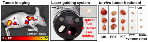 Images from An endoscope with integrated transparent bioelectronics and theranostic nanoparticles for colon cancer treatment